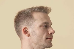 Men’S Haircut For Receding Hairline